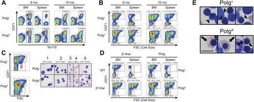 Figure 2. Abnormal erythroid development in aging PolgA mice. Polg+ and PolgA mice were humanely killed for analysis at the indicated ages. Single-cell suspensions were prepared from bone marrow (BM) and spleen (Spleen) without hypotonic lysis, then stained for surface expression of CD71 (transferrin receptor) and the erythroid-specific antigen Ter119. In panels A and B, the individual graphs presented are representative of 3 independent experiments for each age group. In each independent experiment, one PolgA mouse was compared with one or 2 Polg+ littermates. The percentages shown with each region represent the mean frequency of that population, as a percentage of all singlet events, across all 3 experiments for the indicated age group. Each region was analyzed for statistically significant differences in frequency between genotypes using the Student t test (*P < .05, **P < .01). (A) All events remaining after exclusion of debris and nonsinglet events (80%-90% of all events; data not shown) were analyzed on the basis of expression of CD71 and Ter119. (B) The regions indicated in panel A were further analyzed on the basis of FSC, a surrogate for cell size relative to expression of CD71. (C) After the exclusion of both lineage+ and nonviable cells (see “Flow cytometric analysis” in supplemental Methods) as well as gating as described in panel A, cells from 5 populations were sorted by use of the indicated regions. Sorted cells were then spun on slides, stained with Wright-Giemsa, and visualized. All images were acquired at identical magnification; bar represents 10 microns. (D) After preparation and analysis as described in panel A, spleen and bone marrow from 6-month-old β-thalassemia (bottom left) and WT littermate control (top left) mice were analyzed as in panel B in parallel with samples from 10-month-old Polg+ (top right) and PolgA (bottom right) mice. These results from a single parallel experiment are representative of results obtained during independent analysis of β-thalassemia and Polg D257A samples (3 and 7 samples, respectively). (E) Whole bone-marrow cell suspensions from 10-month-old Polg+ (left) and PolgA (right) mice prepared as in (C) demonstrate the presence of abnormally hemoglobinized orthochromatic normoblasts (arrows) in PolgA marrow only and normal polychromatic normoblasts (arrowheads) in both Polg+ and PolgA marrow. All images were acquired at identical magnification; bar represents 10 microns.