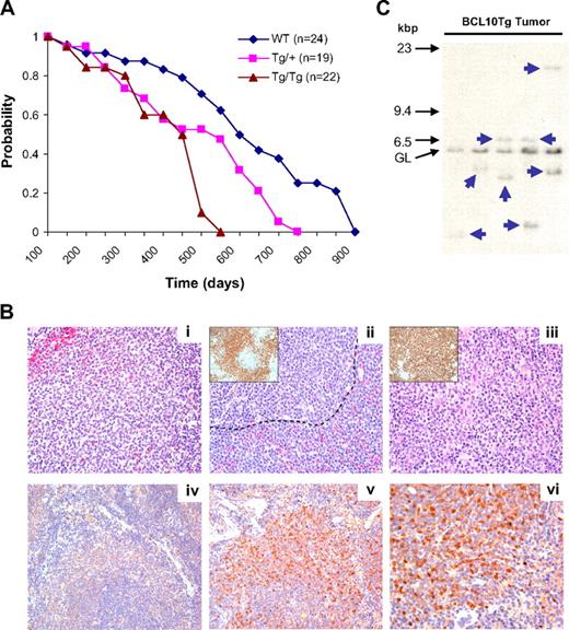 Figure 6. Survival and development of lymphomas in WT, Tg/+, and Tg/Tg mice. (A) Kaplan-Meier survival plot of overall survival of mice of the 3 genotypes. There is a statistically significant difference between survival curves (P = .041). Some mice were examined by necropsy when moribund. (B) Histologic and IHC features of spleens from Tg mice. (i) Low-grade splenic MZL showing enlarged MZ with atypical cells expanding into the red pulp (top left). Small follicular lymphocytes are at bottom right. (ii) Higher-grade MZL with centroblast-like cells both outside the marginal sinus (----) and in the follicle. (Inset) Same spleen stained with Ab to PAX5. (iii) High-grade MZL with the spleen almost totally occupied by cells with uniform features of centroblasts. (Inset) Same spleen stained with Ab to B220 emphasizes the almost total effacement of normal architecture by the aberrant B cells. (iv) Non-Tg spleen stained with Ab to human BCL10. (v) BCL10 Tg spleen with expanded MZ stained with Ab to human BCL10. (vi) Same spleen as in panel Bv, showing nuclear and cytoplasmic localization of BCL10. Histologic images were viewed with an Olympus Ax70 microscope (40×/0.75 oil objective lens) and photographed with an Olympus DP71 camera; DP controller software (Version 3.3.1.292) was used for image acquisition. (C) Southern blot hybridization analyses of Ig heavy chain gene organization in DNA prepared from spleens of 5 Tg/+ mice diagnosed with MZL. Locations of size markers and the germline (GL) band are shown on the left.