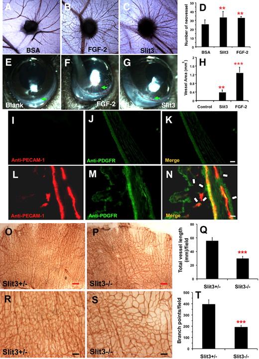 Figure 7. Slit3 promotes angiogenesis in vivo and Slit3−/− mice display disrupted angiogenesis in developing diaphragm. (A-D) CAM assay. Gelfoam sponges soaked with Slit3 (4.0 nmol/L), FGF-2 (18 nmol/L), or BSA (6.5 nmol/L) were applied to chorioallantoic membrane. After 72 hours, the membranes around sponges were fixed and dissected out, and the number of vessels sprouting into sponges were counted and represented as mean ± SD (n = 8 for each group). The asterisk indicates a statistically significant increase compared with BSA treatment (**P < .01 by Student t test). (E-N) Mouse corneal micropocket assay. Hydron pellets containing Slit3 (1.3 nmol/L) or FGF-2 (4.8 nmol/L) were implanted into micropockets of the C57BL/6 mouse cornea. The pellets with only balanced buffers were used as a negative control. On day 5, the corneal neovascularization response to test factors was photographed and quantified. To reduce experimental variation, every mouse was implanted into both eyes with either test-factor or control. n = 8 for each group. Asterisks indicate statistically significant difference in the vessel area of the Slit3-inplanted cornea compared with the control group by Student t test (H,**P < .01; ***P < .001). The mouse corneas were further examined for ECs and pericytes/VSMCs by immunostaining with anti-PECAM-1 (red) and anti-PDGFR (green) antibodies, respectively. The control corneas (I-K) did not show any PECAM-1 position cells, showing that neovascularization was not induced, whereas the Slit3-implanted corneas (L-N) exhibited PECAM-1–positive cells and were covered by PDGFR-positive pericytes/VSMCs (indicated by the arrows), confirming that Slit3 potently induced angiogenesis in cornea. Scale bare = 50 μm. (O-T). Whole-mount staining of embryonic day 15.5 diaphragms of Slit3+/− and Slit3−/− mice with anti-mouse PECAM-1 antibody. Quantification of the vascular parameter showed that, compared with the phenotypically normal littermate control Slit3+/− diaphragm, the Slit3−/− diaphragm showed reduced vascular density and branch points. n = 4-6 for each group. Asterisks indicate statistically significant difference compared with Slit3+/− control by Student t test (***P < .001). Red scale bar = 250 μm; black scale bar = 100 μm.