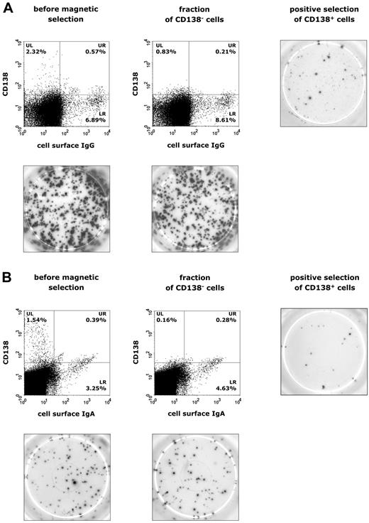 Figure 6. Identification of IgG- and IgA-producing cell populations in patients with CVID or IgAD. Representative results are shown in panel A for CVID patients and in panel B for subjects with IgAD. Expression of CD138 and surface IgG or IgA on lymphogated cells was analyzed before and after magnetic separation of CD138+ plasma cells from PBMCs cultured in the presence of IL-21 (10 ng/mL), IL-4 (0.5 ng/mL), and anti–human CD40 mAb (2 μg/mL) for 5 days. Cell surface expression of these markers is presented on a 4-decade log scale as dot plots of correlated x-axis and y-axis fluorescence. Images of ELISPOT assay were taken after 20 hours of incubation of 5 × 104 PBMCs for IgG production (A) or 1 × 106 PBMCs for IgA production (B).