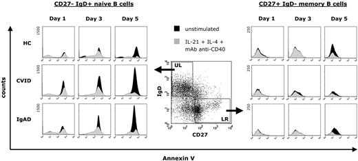 Figure 7. Representative effect of a combination of IL-21, IL-4, and anti-CD40 stimulation on the spontaneous apoptosis of peripheral blood CD19+ purified B cells from patients with CVID or IgAD. After exclusion of dead cells, equal numbers of gated B cells were assayed for annexin V staining cells at days 1, 3, and 5 either without stimulation during culture or after stimulation with IL-21 (10 ng/mL), IL-4 (0.5 ng/mL), and anti–human CD40 mAb (2 μg/mL). Annexin V expression is presented on a 4-decade log scale as histogram plots with a linear scale of the number of events at the y-axis.