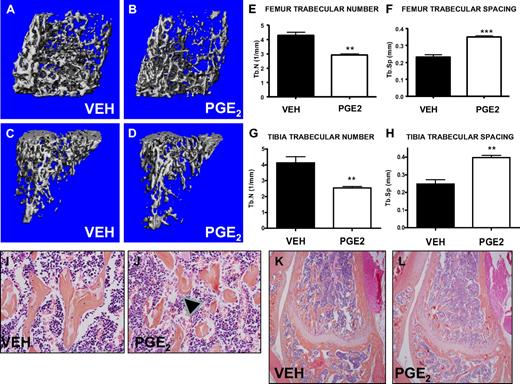 Figure 1. Systemic PGE2 treatment alters bone marrow microarchitecture. Femora and tibiae of vehicle- (VEH) and PGE2-treated mice were analyzed by micro-CT and histology. Three-dimensional reconstructions of representative scanned femora (A-B) and tibiae (C-D) focusing on trabecular bone. Quantification of the trabecular number (E,G) and trabecular spacing (F,H) (n = 4/group). High- (I-J) and low-power (K-L) representative images of histologic slides stained with hematoxylin and eosin, focusing on the metaphyseal region of the distal femur from vehicle- and PGE2-treated mice. Arrowheads indicate disrupted trabeculae in the PGE2-treated mice (J). **P ≤ .01; ***P ≤ .001.