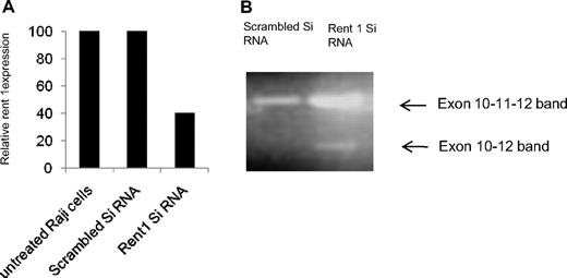 Figure 2. Inactivation of Rent 1. (A) Using a siRNA against Rent 1, this gene was inactivated in Raji cells, a B-cell line. The bar diagram shows relative expression of Rent 1 RNA by real-time RT-PCR analysis in untreated cells, Raji cells transfected with scrambled siRNA, or with Rent 1 siRNA (relative to actin expression). (B) The same cDNA material was analyzed by PCR with primers in exons 10 and 12. An exon 11–skipped transcript is seen in the Rent 1–transfected Raji cells, as indicated by the lower ←.