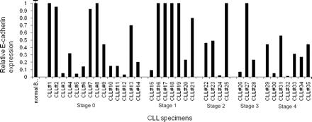 Figure 3. E-cadherin expression in CLL specimens. Total E-cadherin expression was determined by real-time PCR analysis in 35 different CLL specimens from patients. The PCR primers and probe used for analysis detect the junction of exon 10-11. The bar diagram is a relative expression of E-cadherin in CLL specimens compared with normal peripheral blood B cells (n = 4) and adjusted to actin. On the x-axis, CLL specimens are grouped according to Rai clinical stage.