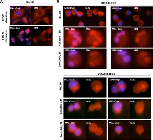 Figure 2. MAL nuclear localization after Rho GTPase activation in MKs. (A) MAL cytoplasmic localization in serum-starved NIH3T3 cells and its nuclear localization after serum stimulation. (B) Cord blood-derived MKs (upper panels) and cytapheresis-derived MKs (lower panels). After adhesion to polylysine for 10 minutes (PLL, 10′), MAL is localized in the cytoplasm. After adhesion to collagen I or convulxin for 2 hours, MAL is localized in the nucleus. Both substrates induce Rho GTPase activation. MAL (red) and 4,6-diamidino-2-phenylindole (blue) staining was detected by immunofluorescence and visualized under a fluorescent light microscope at an original magnification ×60.