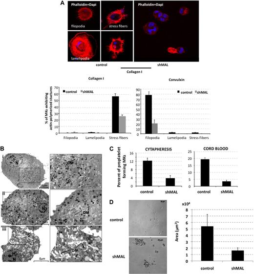 Figure 4. MAL knockdown alters actin polymerization, terminal maturation, and proplatelet formation of MKs. CD34+ cells isolated from cord blood or cytapheresis were transduced with the control lentivirus or the lentivirus encoding shRNA of MAL (shMAL). (A) GFP+ cells (day 8) were allowed to adhere on collagen I or convulxin for 2 hours. Stress fibers, filopodia, and lamellipodia were stained with TRITC-conjugated phalloidin (red) and nucleus with 4,6-diamidino-2-phenylindole (blue). The percentage of MK-forming stress fibers, filopodia, or lamellipodia was evaluated on a total of 500 cells using fluorescent light microscopy (original magnification ×40). (B) Ultrastructural aspect of control (i) and shMAL (ii-iii) transduced MKs. MKs were sorted at day 10 of culture on the expression of GFP and fixed. N indicates nucleus; DM, demarcation membranes. Arrowhead represents α granules. (i) Morphology of a typical normal MK. Bar represents 5 μm. (ii-iii) Morphology of shMAL-transduced MK. (ii) Bar represents 2 μm. (iii) Bar represents 5 μm. (C) GFP+ cells were sorted at day 9 on the coexpression of CD41 and CD42. Cells were seeded at 2 × 103 cells/well in a 96-well plate. The percentage of proplatelet-forming MKs was estimated by counting MKs exhibiting one or more cytoplasmic processes with areas of constriction. A total of 500 cells per well were counted at day 13 for cytapheresis-derived MKs and at day 15 for cord blood–derived MKs. Error bars in histograms represent the SD of one representative experiment performed in triplicate wells. Similar results were obtained in 3 repeated experiments with cytapheresis and 2 experiments with cord blood. (D) MKs derived from cytapheresis were plated as in panel C, and the area of proplatelet network estimated in microns squared was measured using Axio Vision 4.6 software. One representative control- and shMAL-transduced proplatelet-forming MKs is shown on left, and the area mean of 10 cells from each group is shown in the histogram on right. Error bars in histograms represent the SD obtained for 10 cells in one representative experiment (n = 2).