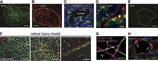 Figure 1. Differential BM contribution results from activation of redundant mechanisms of postnatal neovasculogenesis. Combinations of models of adult neovasculogenesis were established in single mice and result in different levels of BM contribution. (A-B) Lewis lung carcinoma cell (LLC)–based tumors showed GFP+ bone marrow (BM) contribution throughout the tumor mass (A; scale bar represents 100 μm) mainly from CD11b+ cells (B; n = 8; scale bar represents 50 μm). Tumors are outlined with dashed lines. (C-D) Within tumor-associated vasculature, CD31 (C) and claudin-5 (D) staining showed integration from GFP+ BM cells (scale bars represent 20 μm). (E) B16 tumors had low levels of GFP+ BM contribution in comparison with all other models and no contribution within tumor-associated vasculature (n = 8; scale bar represents 100 μm). (F) The most robust contribution was seen in the retinal injury model. This model uses vascular endothelial growth factor (VEGF) overexpression by a recombinant adeno-associated virus type 2 that overexpresses the murine 188 isoform of VEGF-A (rAAV2 VEGF-A 188) and laser-induced ischemic injury to promote robust BM-derived neovascularization. DsRed+ BM-derived blood vessels are shown (middle panel) along with a negative control (left panel; scale bars represent 100 μm). All animals were perfused with FITC-dextran to show functional vasculature (right panel; n = 5; scale bar represents 50 μm). Similar results were observed with GFP+ BM (data not shown). (G) Retinas were costained with α-SMA to confirm endothelial phenotype (n = 5; scale bar represents 50 μm). (H) LLC tumors established in mice that received a transplant of DsRed+ BM along with retinal injury also showed BM integration into tumor vasculature (n = 5; scale bar represents 20 μm). Confocal microscopy with 0.5-micron Z-step analysis was necessary to identify nucleated cells coexpressing donor GFP or DsRed and endothelial proteins (CD31).