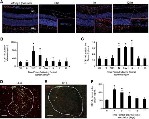 Figure 3. Endogenously produced SDF-1α is a trigger for BM contribution to sites of postnatal neovasculogenesis. (A) Eyes were harvested and embedded in paraffin at different time points after retinal injury. Tissues were sectioned (5 μm) and staining was performed for SDF-1α and DAPI (4,6 diamidino-2-phenylindole). As expected, consistent expression of SDF-1α in the PRL was observed. Nontreated left eyes served as controls. SDF-1α expression is observed in the GCL at 1 and 12 hours after laser injury (n = 5; scale bar represents 100 μm). (B-C) SDF-1α ELISA of samples from the vitreous and blood serum after retinal ischemic injury. Vitreous fluid and blood serum were obtained from mice at different time points after retinal injury. ELISA analysis showed a direct correlation to the staining results with significant increases in SDF-1α levels observed at 1 hour and 12 hours in the vitreous (B) and blood serum (C), respectively (n = 5; *P < .05). (D-E) SDF-1α expression was also observed in LLC tumors (D) with nondetectable levels seen in B16 tumors (E). Tumors are outlined by dashed lines (n = 8; scale bars represent 100 μm). (F) ELISA analysis of SDF-1α in the serum of mice inoculated with both LLC and B16 tumors showed a significant increase in serum levels 7 days after tumor inoculation, with levels returning to background by day 13 (n = 5; *P < .05).