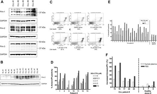 Figure 2. Expression of Pim kinase and the effect of SGI-1776 on apoptosis induction in CLL primary cells by SGI-1776. (A) Protein expression of Pim-1, -2, and -3 in untreated CLL primary cells. CLL lymphocytes were lysed and analyzed by immunoblot for Pim kinases with GAPDH as a loading control. (B) Elevated Pim-2 protein levels in CLL primary cells compared with normal lymphocytes. CLL lymphocytes and normal lymphocytes obtained from healthy donors were analyzed by immunoblot for Pim-2 protein as described in panel A. The IgVH mutation status for the CLL patients were as follows: unmutated (nos. 1, 4, 5, and 6), mutated (nos. 3, 7, 8), and undetermined (no. 2). (C) Flow cytometry analysis of annexin-FITC/PI staining of CLL primary cells (patient no. 1) that were either untreated; treated with 0.1% DMSO vehicle alone; or with 0.3, 1, 3, or 10 μmol/L SGI-1776 for 24 hours. (D) Graph of cell death in CLL samples (n = 7) from treatment with either 0, 0.3, 1, 3, or 10 μmol/L SGI-1776 for 24 hours. (E) Graph of cell death in untreated samples or samples treated with 10 μmol/L SGI-1776 for 24 hours in CLL (n = 19) and lymphocytes from healthy donors (n = 3). (F) Graph of the increase in apoptosis in CLL cells treated with 10 μmol/L SGI-1776 for 24 hours cultured in either media supplemented with autologous human plasma or FBS. Annexin V binding assay was used for apoptosis assay as described in “Apoptosis assay.”
