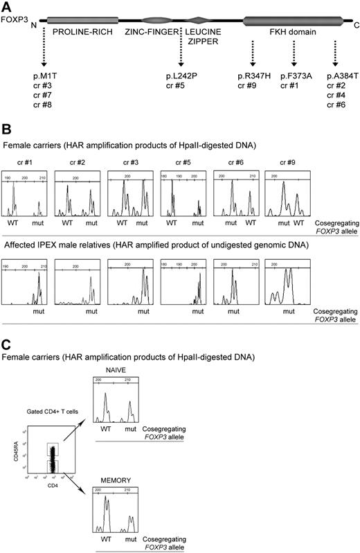 Figure 1. The pattern of XCI in PBMCs and CD4+ T-cell subsets derived from carriers of FOXP3 mutations is random. (A) Carriers 1, 2, 4, 6, and 9 have mutations in the forkhead/winged-helix (FKH) DNA-binding domain, whereas carrier 5 has a mutation in exon 6 between the C2H2 zinc finger and the leucine zipper domains. Carriers 3, 7, and 8 have a nucleotide substitution within the ATG translation start site, which completely abrogates the expression of the FOXP3 protein (FOXP3-null mutation; S.D.N., unpublished data, November 7, 2008). Carriers 2 and 4 and carriers 3, 7, and 8 are members of the same families. (B) Pherograms of XCI analyses of total PBMCs derived from carriers of FOXP3 mutations are shown (top panel). For carriers who are members of the same family (carriers 2 and 4, carriers 3, 7, and 8) only the pherogram of PBMCs derived from 1 representative subject is shown. CAG repeats of the HAR gene were amplified after digestion with the methylation-sensitive enzyme HpaII so that only methylated (inactive) sequences were amplified. For each HAR allele, the cosegregating WT or mut-FOXP3 allele is indicated according to CAG repeats that cosegregate with the mut-FOXP3 in the relevant IPEX patients (bottom panel). Genomic DNA derived from PBMCs of IPEX patients was not digested because in males the unique X-chromosome is unmethylated and active. (C) XCI was analyzed in CD4+ naive and memory T cells sorted according to their expression of CD45RA. The pherograms of CD4+ T-cell populations of the representative carrier 4 are shown. cr indicates carrier.