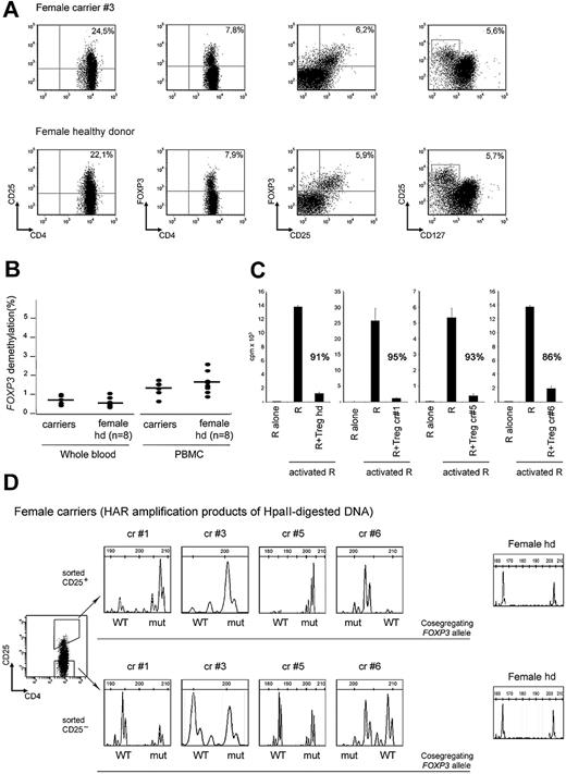 Figure 2. Carriers of FOXP3 mutations have functionally normal nTregs with exclusive expression of the WT-FOXP3 allele. (A) Expression of FOXP3, CD25, and CD127 in CD4+ gated PBMCs derived from the representative carrier 3 (top panel) and a representative healthy female donor (bottom panel). (B) FOXP3 TSDR demethylation levels in genomic DNA samples from whole blood and total PBMCs derived from carriers of FOXP3 mutations and healthy donor females (n = 8). (C) The ability of freshly isolated CD4+CD25+ T cells (Treg) of carriers 1, 5, and 6 and of a representative healthy donor to suppress activated responder CD4+CD45RO+ effector T cells (R) is shown. Percentages indicate the inhibition of proliferation. Error bars indicate SD. (D) The pherograms of XCI analyses of sorted CD4+CD25hi (top panel) and CD4+CD25− (bottom panel) T cells derived from carriers 1, 3, 5, and 6 (n = 4) and from 1 representative healthy female donor (n = 3) are shown. In CD4+CD25hi T cells derived from carriers of FOXP3 mutations, only the inactive repeats that cosegregate with the mut-FOXP3 allele can be amplified, indicating that only the WT-FOXP3 allele is active. In contrast, in CD4+CD25hi T cells derived from healthy donors (n = 3) both the chromosomes are active. In sorted CD4+CD25− T cells derived from carriers of FOXP3 mutations (n = 4) and healthy female donors (n = 3), CAG repeats of both chromosomes can be amplified, indicating that both the WT and the mut alleles are active. For each repeat the cosegregating WT and mut-FOXP3 alleles are indicated. cr indicates carrier; hd, healthy donor.