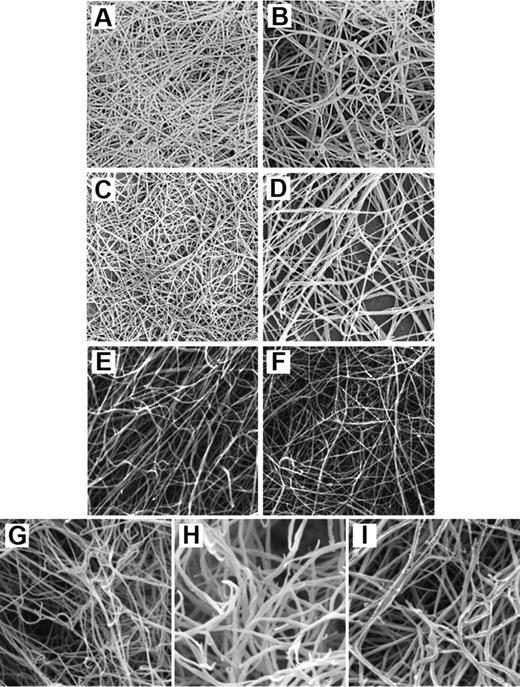 Figure 3. Scanning electron micrographs of purified and recombinant fibrinogen γ-chain variants. (A) Clot made from purified γA/γ′ fibrinogen. (B) Clot made from purified γA/γA fibrinogen. Both clots were made with final concentrations of 0.7 mg/mL fibrinogen and 1 IU/mL thrombin. Reprinted from Cooper et al33 with permission. (C) Clot made from purified γA/γ′ fibrinogen. (D) Clot made from purified γA/γA fibrinogen. These clots were made with final concentrations of 180 μg/mL fibrinogen and 0.1 U/mL thrombin. Reprinted from Siebenlist et al,30 with permission. (E) Clot made from recombinant γ′/γ′ fibrinogen. (F) Clot made from recombinant γA/γA fibrinogen. These clots were made with 10 μL of 4.4 μM fibrinogen and 0.9 IU/mL thrombin. Reprinted from Collet et al70 with permission. (G) Clot made from recombinant γ′/γ′ fibrinogen. (H) Clot made from recombinant γA/γ′ fibrinogen. (I) Clot made from recombinant γA/γA fibrinogen. These clots were made with 1.0 mg/mL fibrinogen and 0.1 U/mL thrombin. Reprinted from Gersh et al76 with permission.