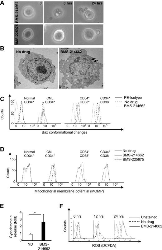 Figure 2. BMS-214662 treatment induces mitochondrial-mediated apoptosis in CD34+, CD34+38−, and CD34+38+ CML cells. (A) CD34+ CML cells were treated with 250nM BMS-214662 or BMS-225975 for up to 24 hours and observed under phase-contrast microscope. (B) Transmission electron microscopy of CD34+ CML cells treated with 250nM BMS-214662 for 12 hours. Arrows indicate mitochondria. (C) CD34+ normal and total CML CD34+, CD34+38−, and CD34+38+ cells were treated as indicated for 24 hours and conformational changes of Bax were measured (CD34+, n = 3; CD34+38− and CD34+38+, n = 2). (D) MOMP was measured in CD34+ normal and total CML CD34+, CD34+38−, and CD34+38+ cells after 24 hours of treatment with 250nM BMS-214662 (n = 3). (E) Densitometry analysis showed release of cytochrome c in CML CD34+ cells to the cytoplasm after 24-hour treatment with 250nM BMS-214662 (n = 3). Error bars represent ± SD. *P = .026. (F) CD34+ CML cells were treated as indicated and levels of ROS were measured by FACS (n = 3).
