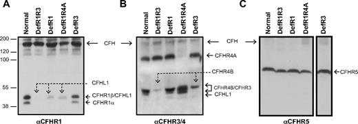 Figure 1. Identification of CFHR proteins deficiencies in serum samples. Serum samples from control persons, patients with aHUS, and patients with GN were analyzed by SDS-PAGE and Western blot analysis by using 3 different antibody preparations (A-C) that recognize fH and CFHR proteins. Labels on the top of each gel refer to the 5 CFHR patterns observed: the most frequent pattern in which all the CFHR proteins analyzed are present (Normal), and 4 additional patterns showing different CFHR deficiencies (DefR1R3, DefR1, DefR1R4A, and DefR3). The serum samples chosen to illustrate the 5 patterns correspond to the control sample C1 and to the patients with aHUS H13, H119, H177, and H123, respectively. The position and size (kDa) of the molecular weight markers are shown to the left of gel A. The lane showing the DefR3 pattern in panel C has been repositioned.