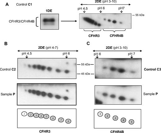 Figure 5. Characterization and variability of the CFHR3/CFHR4B region. (A) Separation of CFHR3/CFHR4B isoforms by 2DE. Western blot obtained with the heparin-sepharose eluate from control persons C1 and the αCFHR3/4 antibody preparation. (B) CFHR3 and (C) CFHR4B isoform patterns observed in individual samples (C2, C3) or in the pooled-control sample (P). The pH range used in the IEF step is shown at the top of the gels, and a schematic representation of each pattern is shown at the bottom.