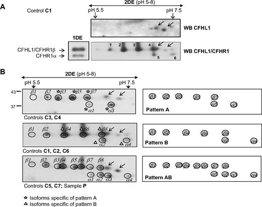 Figure 6. Characterization and variability of the CFHR1/CFHL1 region. (A) Two-dimensional electrophoretic analysis of the heparin-sepharose eluate obtained from control person C1, followed by Western blot with a polyclonal antibody preparation recognizing CFHR1 and CFHL1, or with a monoclonal antibody specific for CFHL1. Only the gel area corresponding to the CFHR1/CFHL1 region is shown. Spots numbered from 1 to 6 were picked up from a replicate gel stained with Coomassie and were identified as CFHR1 by matrix-assisted laser desorption-ionization time-of-flight spectrometry in a 4700 Proteomics Analyzer (PerSeptives Biosystems). (B) CFHR1 isoforms observed after 2DE and Western blot analysis of heparin-sepharose eluates from different control persons. C1 to C7 indicate individual samples; P, pooled-control sample. Isoforms characteristic of patterns A or B are labeled. Arrows indicate CFHL1 isoforms. A scheme of the 3 isoform patterns observed is shown on the right. The molecular weights (kDa) of the CFHR1 isoforms are indicated at the left.