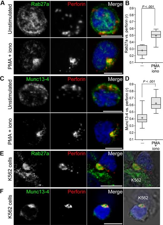 Figure 2. Induction of Rab27a and Munc13-4 colocalization with perforin on activation of resting NK cells. Resting NK cells were incubated alone, stimulated with PMA and ionomycin, or incubated with K562 cells, as indicated, for 20 minutes at 37°C, followed by fixation, permeabilization, and labeling. Cells were labeled with anti-perforin mAb and polyclonal antibodies to Rab27a (A,E) or Munc13-4 (C,F). Confocal images of single, representative cells are shown, with scale bars representing 5 μm. Colocalization between perforin and Rab27a (B) or Munc13-4 (D) was calculated as Pearson correlation coefficient, r, using the JACOP plugin in ImageJ and averaged for 10 to 15 cells from 10 individual donors. Plots represent cumulative data from 10 to 15 cells from each of 5 donors. Plus symbols represent mean values, and error bars represent SD. Boxes represent the 25th, 50th, and 75th percentiles. Two-tailed paired Student t tests were performed to assess significance.