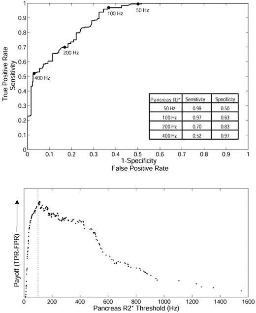 Figure 2. ROC analysis between pancreatic R2* and the presence or absence of cardiac iron in TM. (Top) The ability of pancreatic R2* to predict the presence or absence of MRI-detectable cardiac iron (cardiac R2* > 50 Hz). (Bottom) The diagnostic payoff is maximized near 100 Hz.