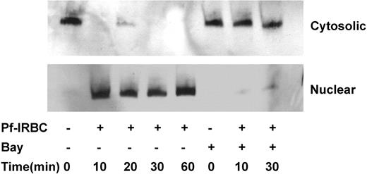 Figure 6. The kinetics of p65 NF-κB nuclear translocation of Pf-IRBC–activated HBMECs and inhibition by IκB phosphorylation inhibitor Bay 11-7082. Confluent HBMECs were incubated in the absence or presence of Pf-IRBCs (5 × 108/100 × 20-mm culture dishes) for the times indicated. In addition, cells were also pretreated with Bay 11-7082 for 1 hour where indicated. Cytosolic and nuclear proteins (25 μg) were resolved on sodium dodecyl sulfate–polyacrylamide gel electrophoresis and Western blotting was performed.