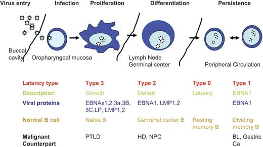 Figure 1. EBV latent life cycle. Virus enters though mucosal routes (shown is the buccal cavity), then infects normal naive B cells circulating through mucosal sites. Virus expresses type 3 latency, which drives B-cell proliferation and expands the infected memory pool. B-cell differentiation into the memory compartments occurs in germinal centers driven by type 2 latency proteins. Infected memory B cells exiting the germinal center down-regulate viral proteins and are invisible to the immune response. EBNA1 is expressed during homeostatic proliferation to maintain the latent viral episome. Virus replication is induced at mucosal sites, and virus is released into the saliva. PTLD indicates posttransplantation lymphoproliferative disease; HD, Hodgkin disease; NPC, nasopharyngeal cancer, and BL, Burkitt lymphoma.