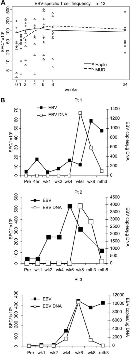 Figure 4. In vivo expansion and clinical benefits of EBV-specific T cells. (A) Frequencies of peripheral blood T cells responding to EBV-LCL by IFN-γ secretion before and after CTL infusion in 12 patients. Individual haploidentical recipients (n = 5) are represented by circles, and MUD recipients are represented by triangles (n = 7). Mean values are represented by lines: solid for haploidentical transplant recipients and dashed for MUDs. (B) Increase in the mean frequency of EBV-LCL-responsive peripheral blood T cells in patients 1, 2, and 3 is related to a decrease in EBV-DNA levels.