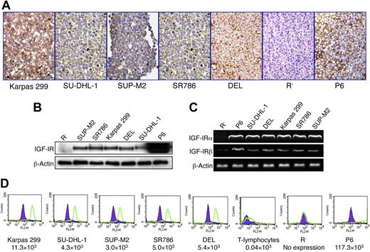 Figure 1. Expression of IGF-IR by ALK+ ALCL cell lines. (A) Immunohistochemical staining demonstrates the expression of IGF-IR protein in 5 ALK+ ALCL cell lines: Karpas 299, SU-DHL-1, SUP-M2, SR786, and DEL. The cell lines R− and P6 were used as negative and positive controls, respectively. The expression of IGF-IR is limited to the cell membrane and cytoplasm, whereas the nuclei are negative (original magnification, ×400). (B) WB studies confirm the results. It is important to note that the overexpression of IGF-IR in P6 cells does not represent a physiologic level. (C) RT-PCR shows the presence of IGF-IR mRNA in the ALK+ ALCL cell lines as well as in the P6 cell line. Although IGF-IRα mRNA is not detectable in R− cells, these cells appear to express very low levels of IGF-IRβ mRNA. (D) Quantitative flow cytometric analysis shows that the ALK+ ALCL cell lines express significantly higher levels of IGF-IR compared with normal human T lymphocytes. R− and P6 cell lines were used as negative and positive controls for the expression of IGF-IR, respectively. The estimated numbers of IGF-IR molecules/cell are shown.