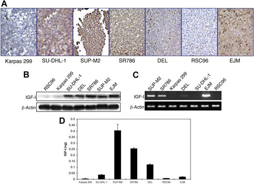 Figure 2. Expression of IGF-I by ALK+ ALCL cell lines. (A) Immunohistochemical staining of ALK+ ALCL cell lines demonstrates the expression of IGF-I in 4 cell lines: SU-DHL-1, SUP-M2, SR786, and DEL. Karpas 299 cells are negative for IGF-I. RSC96 and EJM cells served as negative and positive controls, respectively. The expression of IGF-I is cytoplasmic, and the cell membranes and nuclei are negative (400×). (B) WB shows similar findings. (C) RT-PCR shows the presence of IGF-I mRNA in SUP-M2, SR786, DEL (low level), and EJM, and its absence in Karpas 299, SU-DHL-1, and RSC96. (D) ELISA supports autocrine release of IGF-I. SUP-M2, SR786, and DEL cell lines demonstrate the presence of IGF-I in cell culture supernatants. The EJM cell line was included because it expresses IGF-I protein and mRNA. IGF-I is almost undetectable in cell culture supernatants from Karpas 299 and RSC96 cells. The experiment was repeated 3 times, and the results are shown as the mean ± SD. P < .01 for SUP-M2, SR786, and DEL compared with other cell lines.
