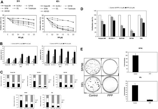 Figure 5. Selective blockade of IGF-IR signaling induces negative biologic effects in ALK+ ALCL cells. (A) PPP induces a concentration- and time-dependent decrease in ALK+ ALCL cell viability, as measured by exclusion of staining by trypan blue dye at 24 or 48 hours. Importantly, PPP did not induce similar effects on the cell viability of 2 human benign cell types, namely the normal T lymphocytes and the AG01523 cell line that was derived from normal skin fibroblasts. The results represent 2 consistent experiments. (B) PPP (1 μM for 24 hours) also induces a concentration- and time-dependent increase in apoptotic cell death of ALK+ ALCL cells, as demonstrated by flow cytometry after staining with annexin V. The results are shown as the mean ± SD of 3 experiments. All treatment points were statistically significant compared with control untreated cells (P < .05). (C) Treating ALK+ ALCL cells with PPP (1 μM for 24 hours) induces G2/M-phase cell-cycle arrest. (D) PPP at 24 hours induces concentration-dependent decrease in the proliferation of ALK+ ALCL cells. The decrease in cell proliferation is highly pronounced in SUP-M2 and SR786 cells, with an intermediate effect in Karpas 299 and DEL cells. The results of 3 experiments are shown as mean ± SD. Excluding SU-DHL-1 and DEL cell lines treated with PPP at 1.0 μM, all other treatments were statistically significant compared with control untreated cells (P < .05). (E) Treating ALK+ ALCL cell lines with PPP induces a marked decrease in the potential of these cells to form colonies in soft agar. In the left panel, the effects of PPP on SR786 and DEL cell growth are shown as representative examples. Compared with the plates with control nontreated cells, the plates with treated cells show markedly decreased colony formation (P < .001 for SR786 and P < .01 for DEL). As shown in the right panel, the experiments were repeated 3 times, and the results are depicted as the mean ± SD.