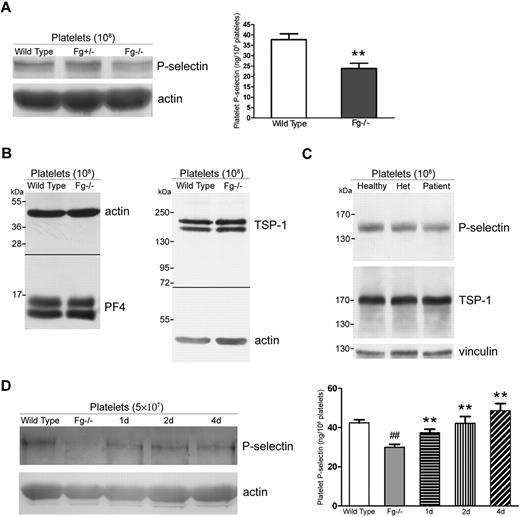 Figure 6. Impaired P-selectin expression on Fg−/− platelets reflects decreased platelet P-selectin content. (A) P-selectin levels in Fg+/+, Fg+/−, and Fg−/− mouse platelets were examined via Western blot. Actin was used as a loading control. A decrease in P-selectin was observed in Fg−/− compared with wild-type and Fg+/− platelets (left panel). Total platelet P-selectin levels were significantly decreased in Fg−/− platelets compared with wild-type platelets, as measured with ELISA (right panel; n = 3; **P < .001). (B) Total platelet PF4 and TSP-1 levels in Fg+/+ and Fg−/− mouse platelets were examined via Western blot. Actin was used as a loading control. No significant difference was observed. (C) Total platelet P-selectin levels in platelets of a healthy donor, the homozygous patient, and his mother (Het) were examined via Western blot. Vinculin was used as a loading control. A decrease in P-selectin was observed in the patient's platelets. A slight decrease was also observed in platelets of the heterozygous parent. No significant difference in the levels of TSP-1 was observed. (D) Total platelet P-selectin levels were examined via Western blot (left panel) and ELISA (right panel). Plasma Fg transfusion restored total P-selectin levels in Fg−/− platelets 1, 2, and 4 days after transfusion. A significant decrease in Fg−/− compared with wild-type platelets was observed via ELISA (n = 3; ##P < .001). Transfusion of plasma Fg significantly increased total platelet P-selectin levels 1, 2, and 4 days after transfusion compared with untreated Fg−/− platelets (shaded) (n = 3; **P < .001). The immunoblots in each panel were developed from the same PVDF (A, C-D) or nitrocellulose (B) membrane and the experiments were repeated at least 3 times.