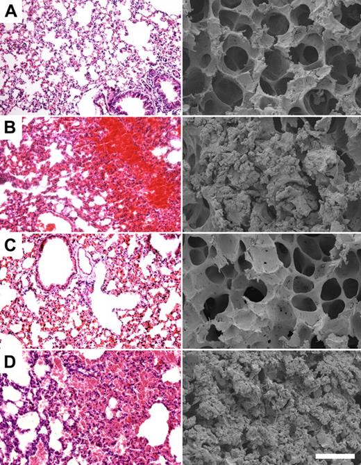 Figure 3. HKH20 prevents lung damage in BALB/c mice infected intraperitoneally with S pyogenes. Light microscopy (left) and scanning electron microscopy (right) of representative mouse lung tissue sections are shown. Mice were injected intraperitoneally with (A) 200 μL PBS, (B) 5 × 106 CFU S pyogenes, (C) 5 × 106 CFU S pyogenes and 200 μg HKH20, and (D) 5 × 106 CFU S pyogenes and 275 μg GCP28. Bars represent 250 μm (light microscopy) and 50 μm (scanning electron microscopy).