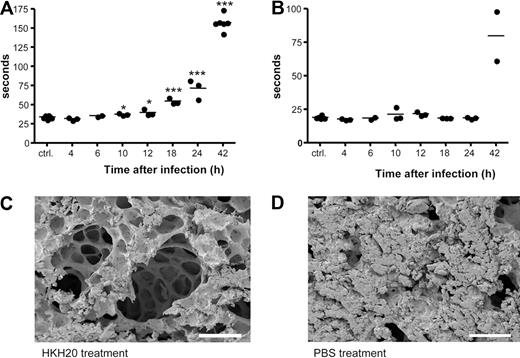 Figure 6. Contact activation in vivo and treatment with HKH20. Mice were injected subcutaneously in the neck with 2 × 107 CFU S pyogenes bacteria, plasma was collected at 0, 4, 6, 10, 12, 18, 24, and 42 hours after infection (n = 2-6/group), and aPTT (A) and PT (B) were measured immediately. *P < .05; ***P < .001. (C) Scanning electron microscopy of representative mouse lung tissue sections is shown. Mice were injected subcutaneously with 2 × 107 CFU S pyogenes and treated intraperitoneally 8 hours after infection with 200 μg HKH20 (C) or 100 μL PBS (D). Lungs were taken 18 hours after infection. Bar represents 100 μm.