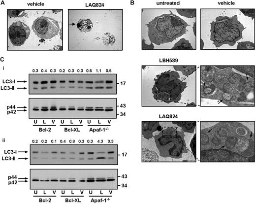 Figure 6. HDACi induce morphologic and biochemical changes associated with autophagy. (A) Eμ-myc lymphoma cells were treated for 24 hours with vehicle or LAQ824 (25 nM) and assessed by TEM. indicates an apoptotic shrunken cell with condensed nuclei; , a cell with a disrupted outer cell membrane. (B) Eμ-myc/apaf-1−/− lymphomas were left untreated or treated for 24 hours with vehicle, LAQ824 (25 nM), or LBH589 (4 nM) and assessed by TEM. Treatment of Eμ-myc/apaf-1−/− lymphoma cells with LAQ824 or LBH589 for 24 hours resulted in the formation of autophagic vacuoles. Higher magnification shows autophagic vacuoles () containing a double membrane. Scale bars represent 5 μm. (C) Eμ-myc/bcl-2, Eμ-myc/bcl-XL, and Eμ-myc/apaf-1−/− lymphomas were left untreated (U) or treated with (i) 4 nM LBH589 (L) or vehicle (V) or (ii) 25 nM LAQ824 (L) or vehicle (V) for 24 hours and analyzed for endogenous LC3 by Western blot (top panels). indicate positions of LC3-I and LC3-II. The ratio of LC3-II to LC3-I was assessed by densitometry and is displayed above each lane. Membranes were stripped and reprobed for p42 as loading control (bottom panels).