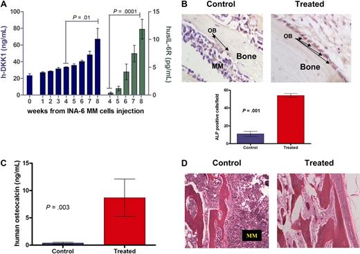 Figure 5. BHQ880 improves bone disease in a murine model of human MM. SCID-hu mice were injected with INA-6 cells into the implanted bone and treated with isotype control (n = 7) or BHQ880 (n = 7) after first detection of tumor. (A) After injection of INA-6 MM cells directly into the human bone implant, serum from SCID-hu mice were monitored for production of DKK1 (blue column) and shuIL-6R (green column) by ELISA. (B) One month after treatment, bone chips were retrieved and decalcified, and sections from control and BHQ880-treated bones were immunohistochemically stained for ALP (top), and the number of OB was measured per field in isotype control and BHQ880-treated bones (bottom). Sections were observed and photographed with a Nikon transmitted light microscope. Original magnification ×200. Data are expressed as ± SD. (C) Serum level of human osteocalcin in murine blood was evaluated at the end of the treatment period by ELISA. Data are expressed as mean ± SD. (D) Sections from control and BHQ880-treated bones were stained by H&E showing increased bone tissue and decreased MM cell number in the BHQ880-treated compared with isotype control-treated samples. Sections were observed and photographed with a Nikon transmitted light microscope. Original magnification ×100.