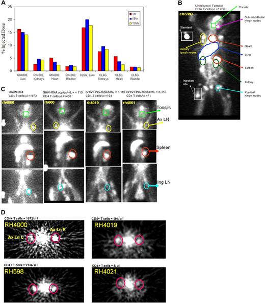 Figure 2. Trans-SPECT images of monkeys with different CD4 T-cell counts. The total amount of injected DTPA-OKT4A/hIgG4 for each monkey was approximately 200 μg. (A) Time-activity curves of the radiotracer for the liver, kidneys, heart, and bladder at 1, 45, and 136 hours after radiotracer injection obtained from the whole-body images acquired in the uninfected RH4000 and the simian HIVDH12R-infected RHCL6G. (B) Trans-SPECT total body image of the uninfected female CH3397. (C) Trans-SPECT sections of 4 monkeys. Spleen, tonsils, and axillary and inguinal lymph nodes regions of interest are circled. (D) Transversal sections of 4 monkeys. Right and left axillary lymph nodes are circled. The radioactivity in the middle is heart blood pool.