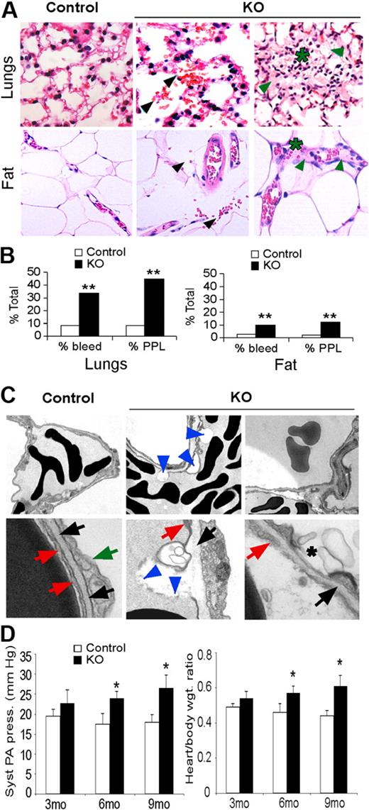 Figure 3. Hif-2α deletion affects lung endothelial cells and capillaries. (A) H&E stain of lungs and adipose tissue from control and KO mice. KO mice show increased bleeding (black arrows), plasma protein leakage (green arrows), and lymphocyte infiltration (*). Original magnification, ×200. (B) Percentage of control and KO mice that show bleeding and plasma protein leakage (PPL) in lungs and adipose tissue from 3- to 6-month-old mice; n = 6; **P < .01. (C) Electron microscopy of lung capillaries from 6-month-old control and KO mice. Electron-dense discs are RBCs. Top row of panels show reduced EC attachment to basement membrane (blue arrowheads) and hemorrhage in KO lungs (original magnification, ×1100). Bottom row of panels show control ECs (red arrows) in contact with the basal lamina (black arrows). Green arrow, type II epithelial cell. KO ECs show areas of detachment from the basal lamina and plasma membrane discontinuity (blue arrowheads) and membrane blebs (*). Original magnification, ×11 000). (D) Systolic pulmonary arterial pressure and heart/body weight ratios reveal significant pulmonary hypertension in 6- and 9-month-old KO mice. Syst PA pressure was increased 1.5 fold in 9-month-old KO mice compared with control mice (*P < .05). Heart-to-body ratio was also significantly increased in 6- and 9-month-old KO mice compared with the control mice (1.4-fold). *P < .05; n = 6.