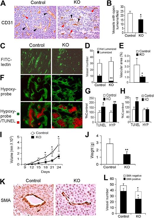Figure 6. Effects of endothelial Hif-2α deletion on tumor angiogenesis. (A) Representative CD31 staining of LLC xenograft tumors, showing decreased numbers of functional vessels (black arrowheads indicate lumenized vessels, defined as vessels with open lumens) in tumors grown in KO mice. Vessels without apparent lumens are indicated by red arrowheads. (B) Quantification of number of vessels with open lumens. (C) Representative field showing FITC-labeled vessels in LLC xenografts. (D-E) Quantification of overall vessel density (total number of vessels, proportion of lumenized vessels) and vascular area. (F) Staining for hypoxia and apoptosis using pimonidazole and Apo-BrdU DNA (TUNEL) fragmentation kit. (G-H) Quantification of pimonidazole and TUNEL stains in large (> 8 mm; G) and small (< 8 mm; H) LLC xenografts. (I) Growth curves for intradermal B16F1 melanoma xenografts in control and KO mice. (J) Weight of B16F1 xenografts harvested after 28 days. (K) SMA staining of B16F1 xenografts grown in control and KO mice, showing similar mural cell coverage. (L) Vessel density, including SMA-positive and SMA-negative vessels, in B16F1 xenografts (n = 6). *P < .05; **P < .01.