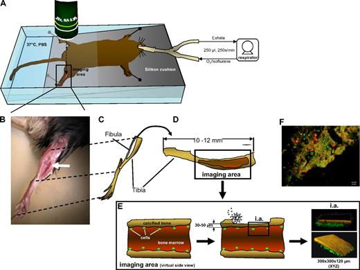 Figure 1. Imaging hematopoietic cell movement in the tibial BM of a live mouse. (A) Setup of the mouse in the imaging chamber. The animal is ventilated through a tracheal tubus by a mechanical small animal respirator receiving a mixture of O2/isoflurane for narcosis at the depicted rates and volumes. The gross area of bone thinning and imaging is boxed and the approximate position of the microscope lens is indicated with a dashed arrow. Imaging is performed anywhere within the red (thinned) area of the tibia. All fluorescently marked cells detectable within this area are recorded by individual Z-stacks. (B) A close-up micrograph of a mouse fixed for imaging with the position of the tibia indicated (white arrow). (C) Drawing of the bones of the hind leg as they are positioned for the animal shown in panel B. (D) Enlargement of the tibial bone, rotated 90° clockwise with the area of preparation indicated by the red color. (E) Virtual side view through the tibial bone in the area of imaging to demonstrate the process of careful bone thinning by an electric drill (silver star), which is constantly monitored with a stereomicroscope until finished. The residual bone surface is kept at 30 to 50 μm thickness, whereas a nondrilled tibia has a wall thickness of approximately 100 μm. Of note: extreme care has to be taken to not totally remove the covering bone. If this happens, the contents of the BM will leak out, rendering imaging impossible in a live mouse with intact blood circulation. The figure on the right shows as an example rendered images of a bone with fluorescently labeled (green) cells below the bone surface. The typical XYZ dimensions of the area of imaging are depicted. (F) To demonstrate the practicability of the transplantation/visualization technique, BM cells were stained with CFSE (green) or CTO (red) and transplanted together in equal numbers in recipient animals. Cells were visualized by 2-photon intravital microscopy in the region close to the endosteum in the tibia (brown = autofluorescence signal of the calcified bone) 16 hours postinjection. The corresponding movie is available as supplemental Video 1.