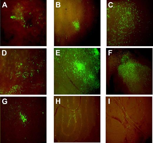 Figure 1. Distribution of eGFP+ cells in hematopoietic and nonhematopoietic tissues in recipient mice at 2 months posttransplantation. (A) Calvarial bone, (B) liver, (C) lung, (D) spleen, (E) pancreas, (F) thymus, (G) fat, (H) testis, and (I) brain are shown. The samples were collected from transplanted animals at sacrifice and imaged in a DMIL-Leica fluorescence microscope with DFC480-Leica camera and 10×/0.22 NA objective.