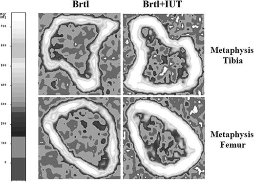 Figure 5. Representative pQCT scans in BrtlIV mice. Shown are scans at the tibial (above) and femoral (below) metaphysis in untreated (left) and treated (right) BrtlIV mice. The treatment induces an increase of bone density at both skeletal sites. The left panel shows the scale of volumetric mineral density.