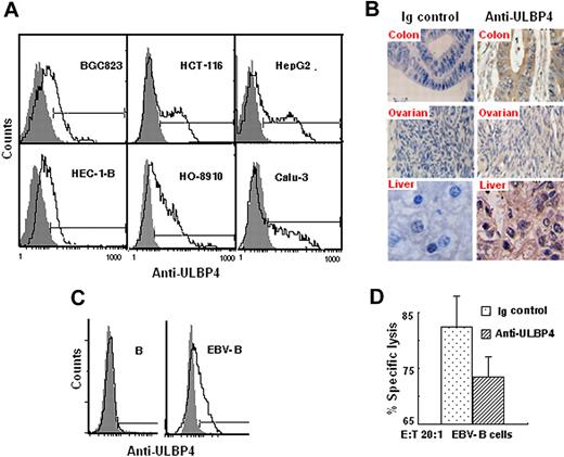 Figure 5. ULBP4 expression on tumor- and EBV-infected B cells. (A) Cell-surface expression of ULBP4 on tumor cells. The indicated tumor cells were stained with unconjugated anti-ULBP4 mAb 8C9 (black line histograms) or control Ig (gray filled histogram) followed by FITC-conjugated goat anti–mouse IgG. Analyses were measured on a FACSCalibur flow cytometer. (B) Immunohistochemistry staining of colonic carcinoma specimen (40×/0.65 NA oil objective lens), ovarian epithelial carcinoma specimens (20×/0.4 NA oil objective lens), and liver carcinoma specimens (40×/0.65 NA oil objective lens). Slides were viewed with a Leica DM3000 microscope. Images were acquired using a Leica DFC420 camera, and were processed with Leica QWin plus version 3.5.0 software. Staining was visualized using diaminobenzidine as the substrate. (C) Surface expression of ULBP4 in B lymphocytes before or after EBV infection. The indicated cells were stained with the anti-ULBP4 mAb 8C9 (black line histograms) or control Ig (gray filled histogram) followed by FITC-conjugated goat anti–mouse IgG. (D) Cytotoxicity of PBMC-Vδ2T cells against EBV-B cells with or without anti-ULBP4 mAb 8C9. Data represent means ± SD (error bars) of 3 independent experiments.