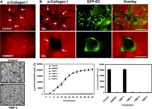Figure 1. MMP activity is required for EC lumen formation and generation of vascular guidance tunnels in 3D collagen matrices. (A) EC cultures were established with or without the addition of the proteinase inhibitors GM6001 (5 μM; top panels) or recombinant TIMP-3 (5 μg/mL; bottom panels). Collagen gels were fixed at 24 hours and processed for immunostaining of the collagen type I matrix (top panels) or were fixed after 48 hours (bottom panels). (Top panels) White arrows indicate the outline of vascular guidance tunnels. Bar equals 50 μm. (Bottom panels) Representative light microscopy images are shown demonstrating quantification of EC lumen formation with and without TIMP-3 addition. Bar equals 100 μm. (B) GFP-ECs were seeded within collagen matrices and allowed to form lumens and tube networks. Cultures were fixed at 96 hours and immunostained for the collagen type I matrix using a collagen type I monoclonal antibody and an Alexa Fluor 594 conjugated secondary antibody. Representative fluorescent images are shown which illustrate that ECs undergo morphogenesis within vascular guidance tunnels. Arrows denote the borders of vascular guidance tunnels. 10×, bar equals 100 μm; 40×, bar equals 25 μm. (C) ECs were suspended in 3D collagen gels and allowed to undergo morphogenesis for 48 hours. Lumen areas per field were determined by tracing EC lumens using Metamorph software from time-lapse images at the indicated time points. The effects of exogenous addition of TIMPs 1-4 and GM6001 on EC lumen formation over the time course is shown, with the adjacent bar graph highlighting EC lumen area at the final 48-hour time point. n = 3 fields per time point.