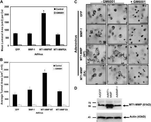 Figure 4. Increased expression of catalytically active but not inactive MT1-MMP increases EC lumen and vascular guidance tunnel formation. (A) ECs transfected with the indicated adenovirus were cultured for 24 hours, fixed, stained, and photographed. Adenoviral vectors used were control GFP, MMP-1, wild-type MT1-MMP (MT1-MMPWT), and mutant MT1-MMP (E240A) to inactivate the catalytic activity of the enzyme (MT1-MMPEA). Mean lumenal area in micrometers2 was measured, with bars representing area ± SD (P < .01). Blockade of this response is seen in all cell types by the addition of 5 μM GM6001, a broad-spectrum chemical MMP inhibitor. (B) Mean vascular guidance tunnel area was measured in micrometers,2 with bars representing area ± SD (P < .01). Blockade of this response is seen in all cell treatments after the addition of 5 μM GM6001, a broad-spectrum chemical MMP inhibitor. (C) Increased expression of MT1-MMP but not other proteins leads to increased EC lumenal area. Cultures were fixed and stained after 24 hours and photographed. Bar equals 50 μm. (D) Western blot analysis demonstrates increased expression of MT1-MMP in ECs after adenoviral infection with AdMT1-MMP but not other adenoviruses.