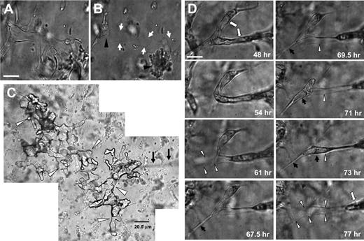 Figure 5. Vascular guidance tunnels are physical spaces in 3D collagen matrices that are generated by MT1-MMP-mediated proteolysis during EC tube morphogenesis, which support EC motility and vascular tube remodeling. (A) ECs were seeded within a 3D collagen matrix and allowed to form vascular tube networks for 48 hours. (B) Vascular networks were rapidly regressed for 10 minutes with the phosphatase inhibitor calyculin A. Arrows indicate borders of vascular guidance tunnels; arrowheads indicate collapsed EC aggregates. Bar equals 25 μm. (C) Silicone oil was injected into vascular guidance tunnels from a single injection site using a 2-μm diameter micropipette (arrows). Cultures were allowed to form (A), were collapsed (B) with calyculin A, and were microinjected. A montage of photographs are shown from this extensive vascular guidance tunnel network present within the 3D collagen matrices (arrowheads) as a result of EC lumen and tube morphogenesis. Bar equals 20 μm. (D) Photographs from time-lapse images showing EC tube remodeling (denoted by white arrows) whereby ECs and tube structures are observed moving through vascular guidance tunnels (outlined by white arrowheads). Black arrows indicate process extension and tube movement into a vacated vascular guidance tunnel space (white arrowheads). Bar equals 25 μm.