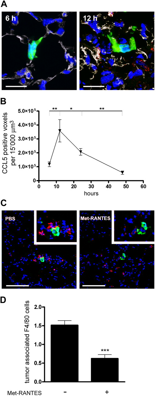 Figure 5. CCL5 recruits monocytes to the metastatic microenvironment. (A) Representative immunofluorescence images of CCL5 detection (red) in lung sections from mice injected with MC-38GFP cells (green). Endothelial cells were stained with CD31 antibody (gray) and nuclei by DAPI (blue). CCL5 expression colocalized with endothelial cells (left side of the 12-hour image). Bar represents 20 μm. (B) Quantification of CCL5 signal in a defined area around MC-38GFP tumor cells (15 000 μm3). CCL5 detection was significantly higher at 12 hours compared with 6 hours and 48 hours after tumor cell injection (**P < .01; *P < .05), tested by ANOVA and Bonferroni posthoc test. (C) Representative images of lung sections from mice treated with Met-RANTES, injected with MC-38GFP cells (green), and killed 48 hours later. Monocytes were detected with F4/80 antibody (red) and nuclei by DAPI (blue). Magnification 40×/0.75 NA oil objective. Bar represents 100 μm. Insets show tumor cell microenvironment at higher magnification (63×/1.30 NA oil objective). (D) Quantification of tumor-associated F4/80-positive cells. Statistical analysis of Met-RANTES– and PBS-treated mice (n = 3); ***P < .001.