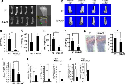 Figure 1. Severe joint destruction and osteoporosis in KRN/G7 mice. (A) Radiographs of femurs of 6-week-old G7 and KRNxG7 mice. (Right panels) Higher magnification images of boxed areas in the left panels. Yellow arrow and dashed circle in lower right panel denote destroyed articular surface and secondary ossification center, respectively. Red arrow points to trabecular bone region. Green arrow indicates microfractures. (B) Representative 3-dimensional reconstruction of the femur by μCT. (C) The percentage of trabecular bone volume/tissue volume (BV/TV) determined by μCT. (D) Trabecular separation determined by μCT (Tb. space). (E) Dual-energy X-ray absorptiometry determined bone mineral density (BMD). Data are presented as mean ± SD; n = 5 in each group of mice. (F) Histomorphometric determination of BV/TV. Trabecular bone volume normalized to total marrow space (BV/TV). (G) TRAP (red reaction product) stained histologic sections of G7 and KRNxG7 tibia. Data are expressed as percentage trabecular bone surface covered by osteoclasts; n = 5. (H) Global osteoclast number, in vivo, was quantified by serum TRAP5b enzyme-linked immunosorbent assay. (I) Oscar, integrin β3, and cathepsin K expression was analyzed by quantitative polymerase chain reaction (PCR) with RNA from G7 and KRNxG7 BM. Shown is the mean expression ± SD for each gene normalized to GAPDH; n = 3. (J) SDF1 and TNF-α expression was analyzed by quantitative reverse-transcribed (RT)–PCR with RNA from G7 and KRNxG7 BM. Shown is the mean expression ± SD for each gene normalized to GAPDH; n = 3. *P < .05. **P < .01. ***P < .001.