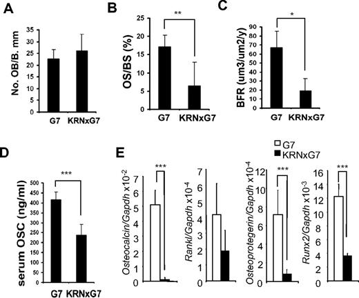 Figure 2. Impaired bone formation rate in KRN/G7 mice. (A) Osteoblast number/millimeter bone perimeter (No. OB/B.mm). (B) Percentage trabecular surface covered by osteoid (OS.S/B.mm). (C) Bone formation rate (BFR) histomorphometrically quantitated from double calcein labeled tibia. (D) In vivo bone formation was quantified by serum osteocalcin (Osc) level at 6 weeks of age (n = 5). (E) RNA of KRN and KRNxG7 BM was analyzed for gene expression of osteoblast markers, receptor activator of nuclear factor-κB ligand (Rankl), Osteoprotegerin (Opg), Runx2, and Osteocalcin by quantitative RT-PCR. Shown is the mean expression ± SD for each gene normalized to GAPDH. *P < .05. **P < .01. ***P < .001.