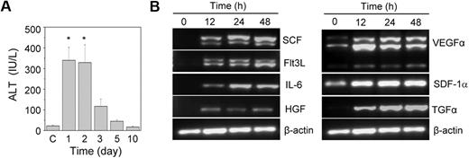 Figure 1. The effect of the acetaminophen treatment on liver function and cytokine gene expression. (A) Acetaminophen was administered to male HA mice by an intraperitoneal injection. At each time interval, the serum ALT level was estimated. Control mice “C” received normal saline (n = 6 for each group). *P < .001. (B) RT-PCR analysis of different growth factor transcripts. Acetaminophen was administered to several mice, and they were killed at 12, 24, and 48 hours. The control mice received saline. A representative gel picture shows the induction of growth factor transcripts in damaged liver tissue.