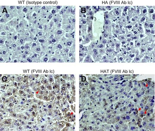Figure 5. Expression of the FVIII light chain protein in liver. Paraffin-embedded serial liver sections of WT, HA, and HAT (5 months of transplantation) mice were stained and examined under a microscope (magnification ×40). (A) Isotype control in WT mice. (B) FVIII-light chain (lc) staining in HA mice. (C) FVIII-light chain staining in WT mice. (D) FVIII-light chain staining in HAT mice. Sections were also stained with secondary antibody alone (data not shown). Representative photomicrographs show the expression of the FVIII light chain protein in WT and HAT mice (red arrows). The light chain antibody staining was specific as no reaction was observed with isotype control antibody. n = 4 for each group.