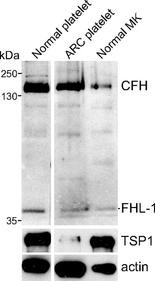 Figure 1. CFH and FHL-1 content in normal platelets, platelets lacking α-granules, and human megakaryocytes. Immunoblot of platelet and megakaryocyte whole-cell lysates consisting of washed platelets (107 platelets/lane) from a normal person (Normal platelet), an ARC syndrome patient (ARC platelet), and serum-free cultured megakaryocytes (Normal MK). The blot was initially probed with a rabbit polyclonal antibody capable of detecting CFH and FHL-1 and subsequently with antibodies specific for TSP1 and β-actin, used as α-granule content and protein-loading indicators, respectively. Both CFH and FHL-1 are present in normal megakaryocytes and platelets, and also in ARC platelets lacking α-granules (near absence of the α-granule protein TSP1).