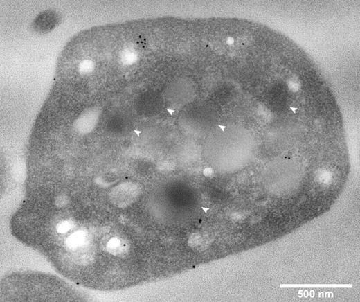 Figure 2. Platelet CFH is distributed throughout the cell and not preferentially localized to α-granules. Thin-section TEMs of representative normal platelets immunogold labeled for CFH (original magnification ×40 000). White bar represents 500 nm; white arrows, α-granules. Primary anti-CFH rabbit polyclonal antibody was detected by immunogold-tagged (10 nm) secondary antibody (black spots). Immunogold-CFH was distributed throughout the cytoplasm with some on the surface but none in recognizable α-granules (compare white arrows with black spots).